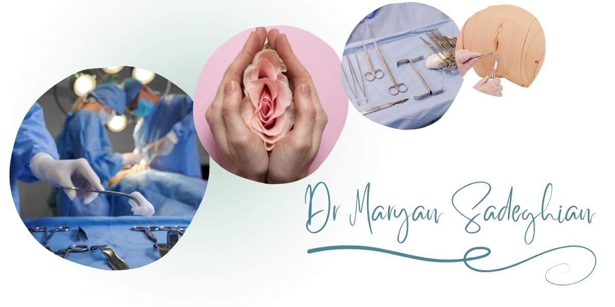 چرا دکتر صادقیان بهترین پزشک برای جراحی پرینورافی در یزد است؟