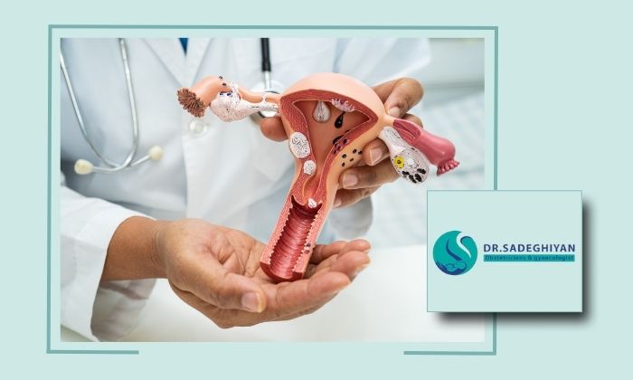  درمان افتادگی رحم چگونه انجام می شود؟ بهترین روش های درمان