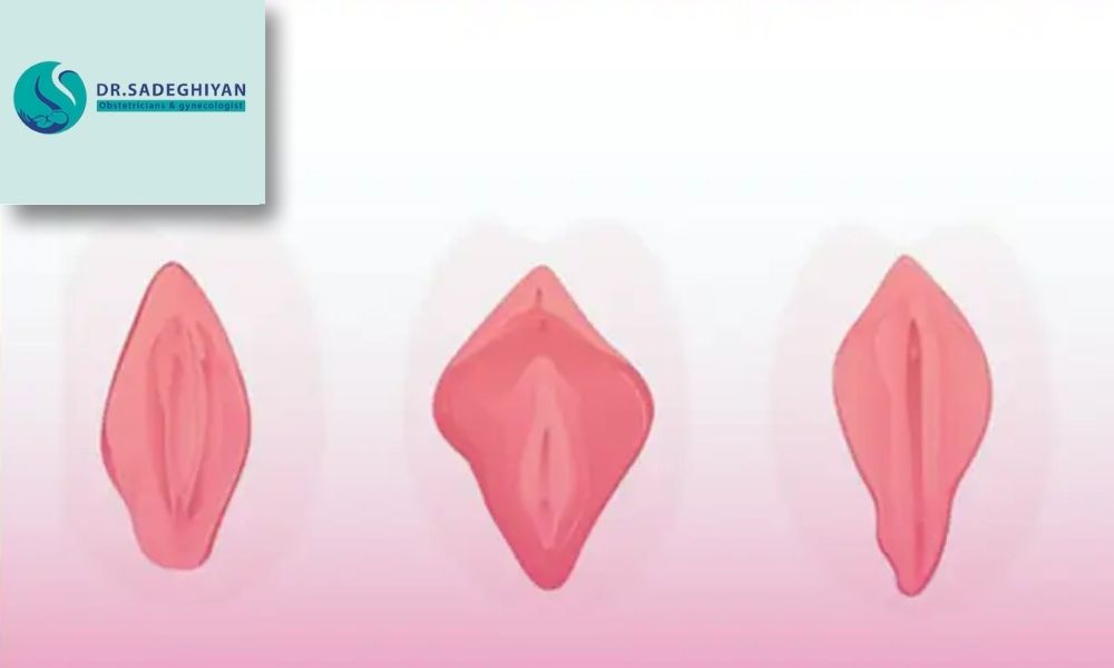 دلایل نیاز به انجام