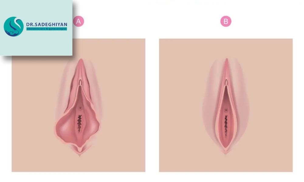 مراقبت های پس از جراحی