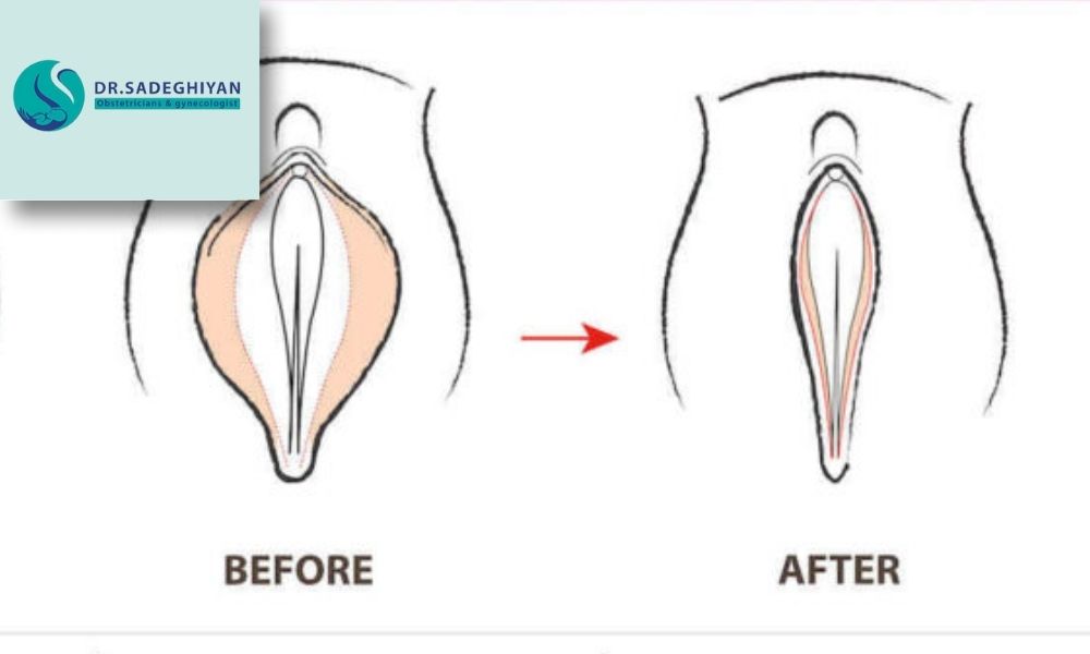 اقدامات قبل از جراحی