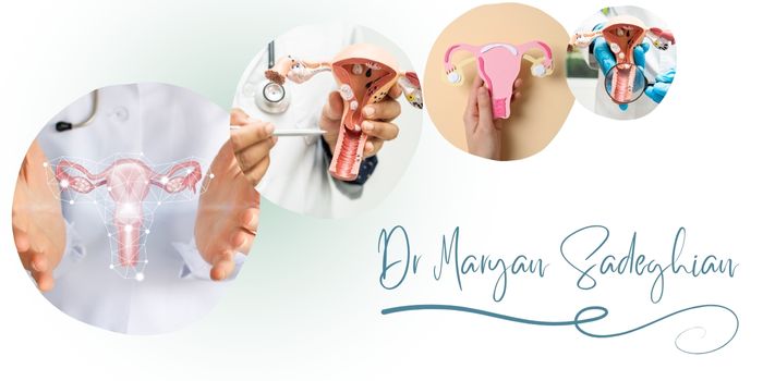 بهترین مرکز لیزر زخم دهانه رحم در یزد