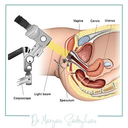 مزایای لیزر درمانی