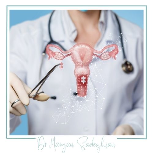 هزینه لیزر زخم دهانه رحم در یزد