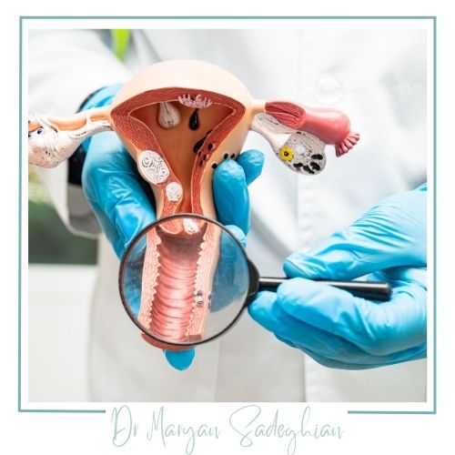 مراحل انجام