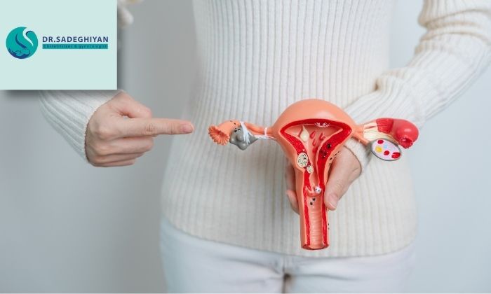 آمادگی قبل از هستروکتومی