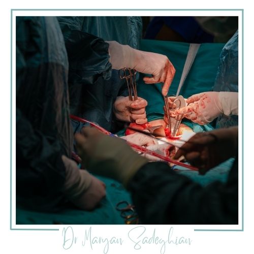 روش‌های انجام عمل