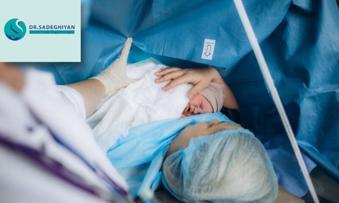 علت‌های انجام این روش