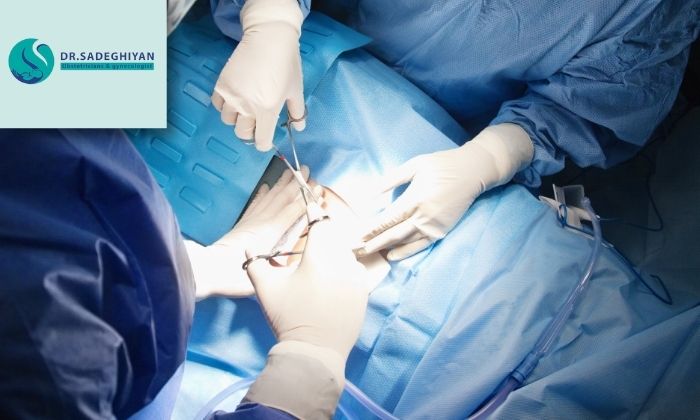 فرآیند جراحی