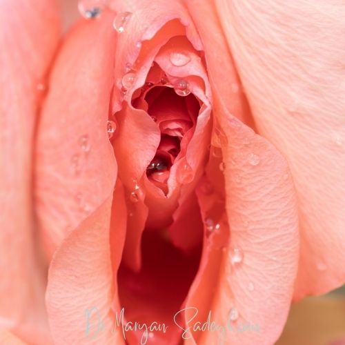 مراقبت‌های بعد از لیزر