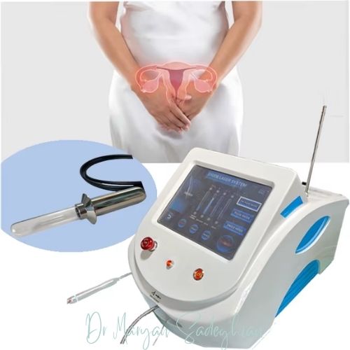 مزایای لیزر زیبایی واژن