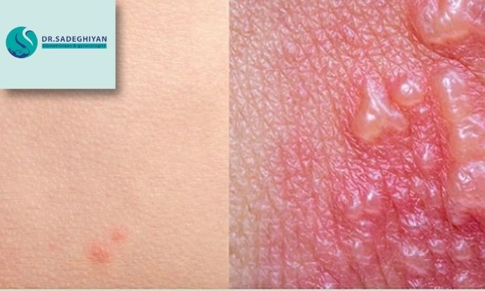 روش‌های درمانی مختلف