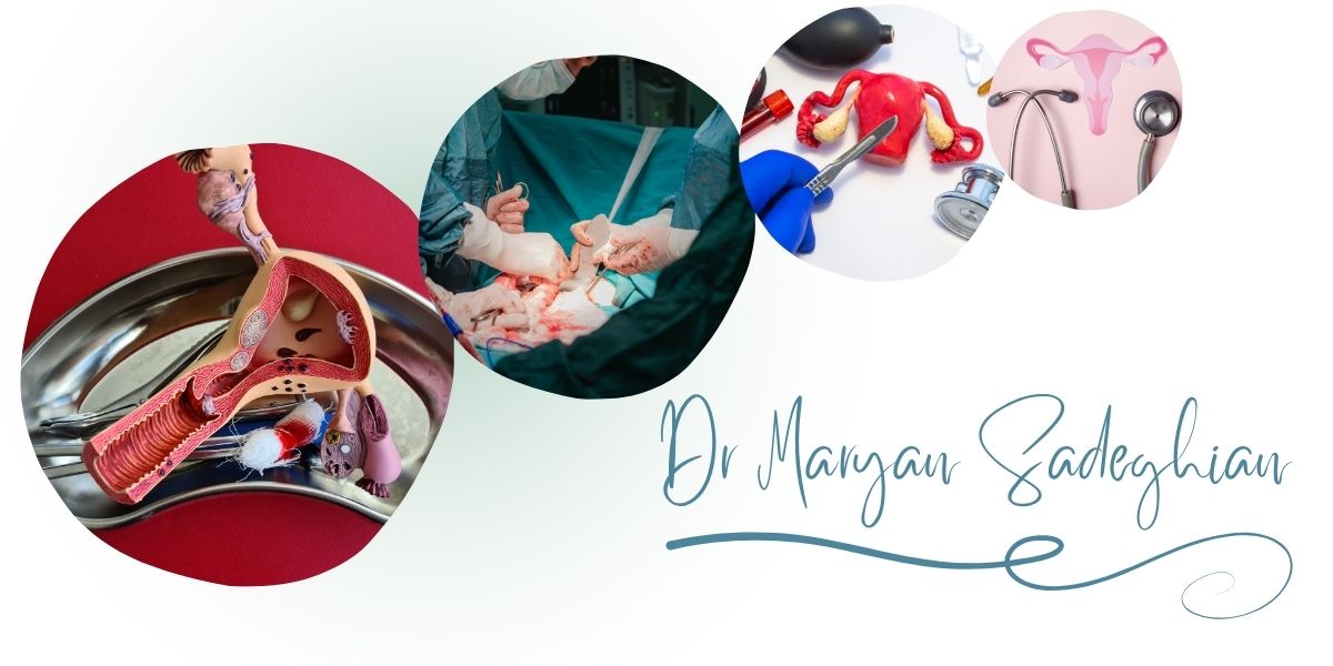 بهترین پزشک برداشتن رحم در یزد