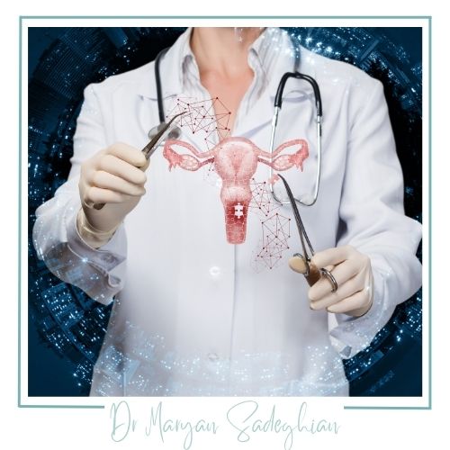 هزینه برداشتن رحم در یزد