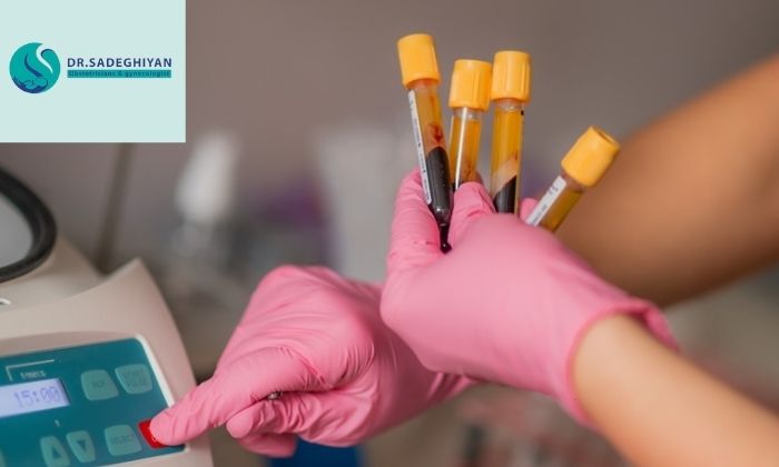 مزایای درمان واژینال با استفاده از پلاسما