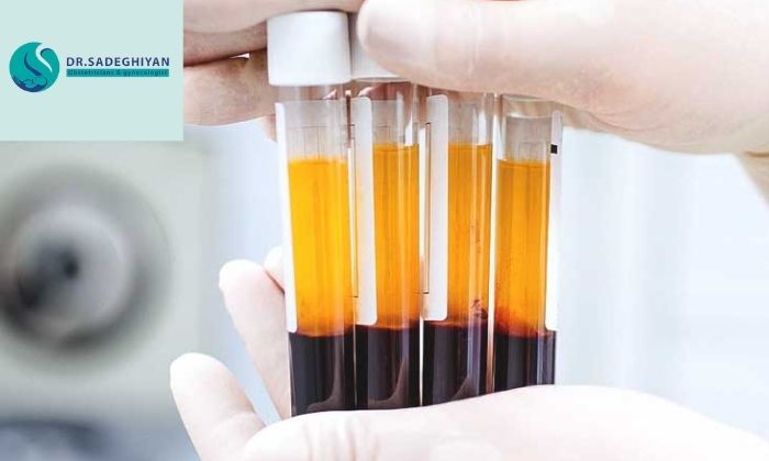 مراقبت های بعد از تزریق 