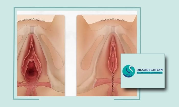 بهترین جراح واژینوپلاستی در یزد با تجربه و مهارت بالا