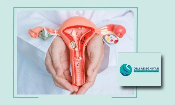 چه بیماری‌هایی باعث نیاز به برداشتن رحم می‌شوند؟