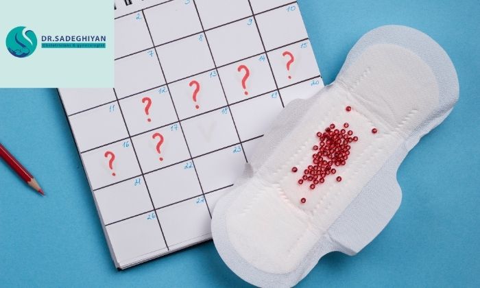 دلایل اصلی پریود نامنظم در زنان کدام‌اند؟