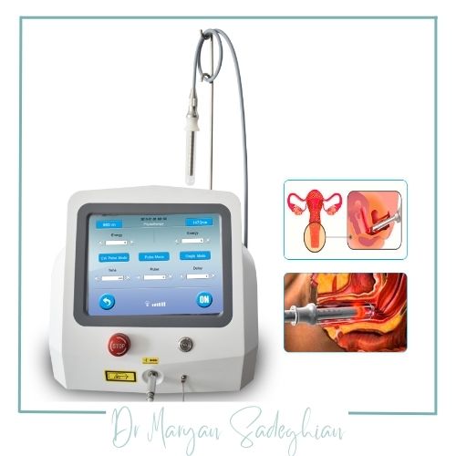 سایرکاربردهای لیزر درمانی در زنان