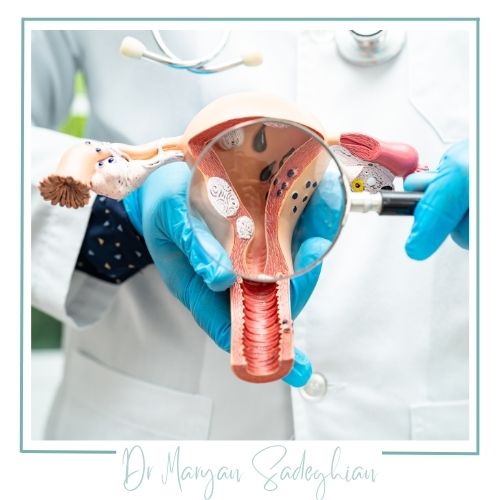 پیشگیری از شل شدن رحم