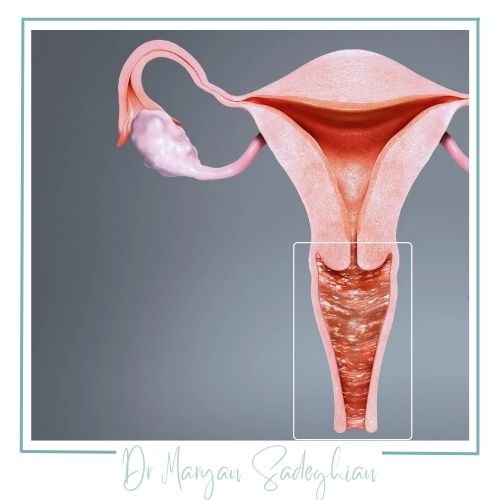 علائم عفونت 