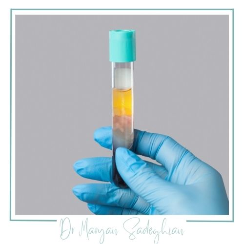 پی آر پی چیست؟