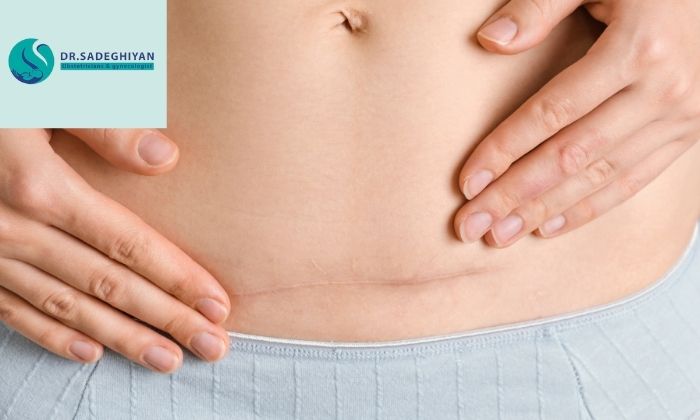 چگونه درد پس از جراحی را کنترل کنیم؟