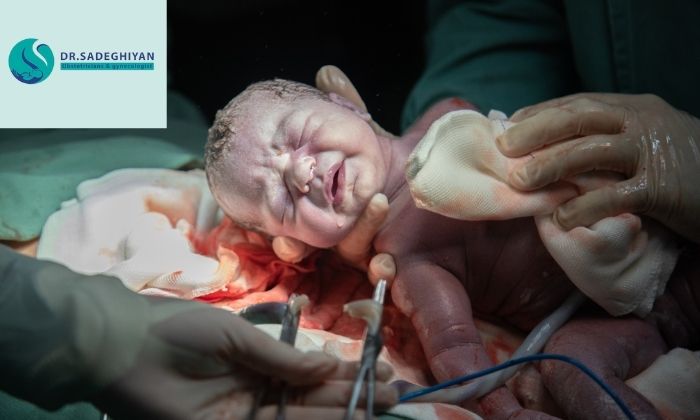 راه‌های پیشگیری از عفونت بعد از سزارین