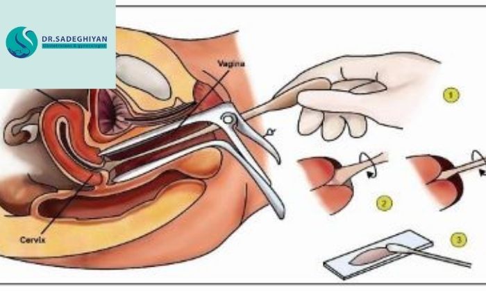 روش‌های تشخیص 