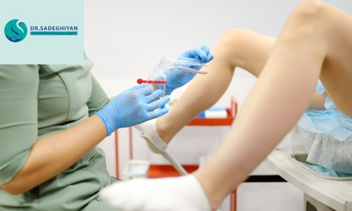 روند انجام تست پاپ اسمیر