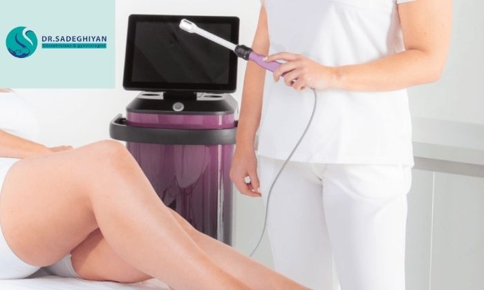 مزایای لیزر نسبت به جراحی افتادگی واژن