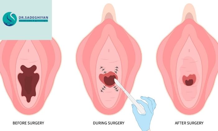 چه کسانی بهتر است جراحی کنند؟