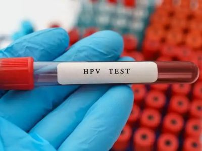 تست HPV