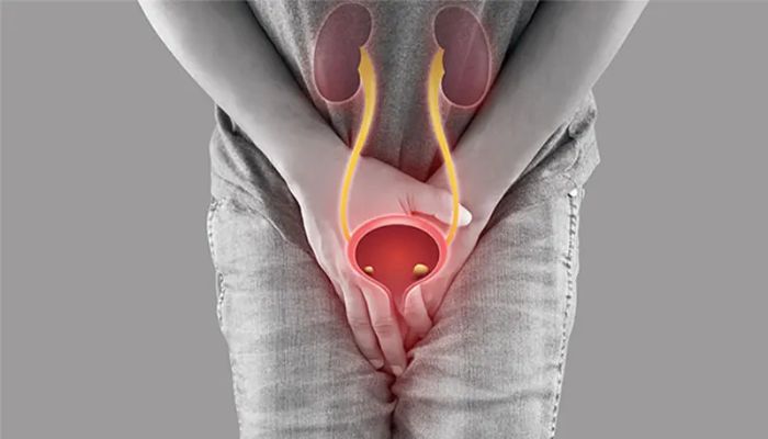 درمان بی اختیاری ادراری با لیزر