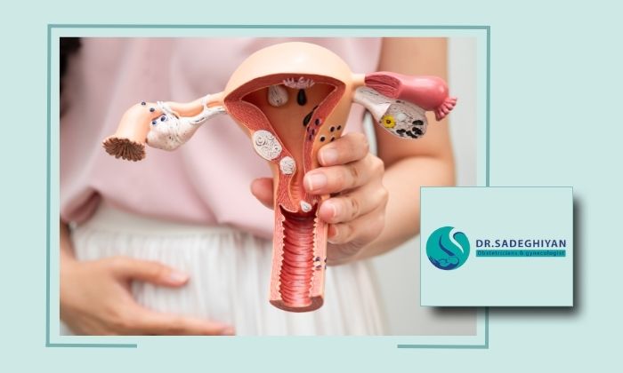 آیا برای درمان فیبروم‌های رحمی نیاز به جراحی است؟