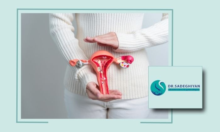 برداشتن رحم در یزد توسط پزشک متخصص زنان