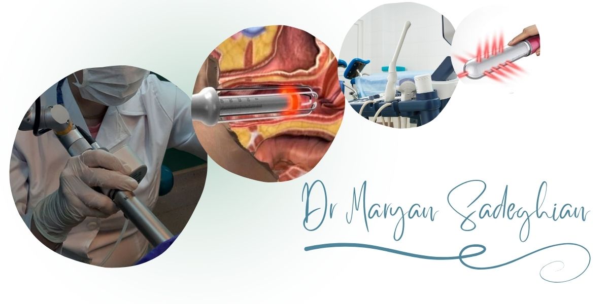 بهترین مرکز جوانسازی واژن با لیزر در یزد