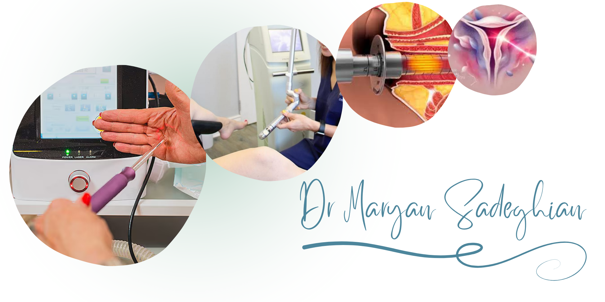 بهترین مرکز لیزر زیبایی ناحیه تناسلی در یزد