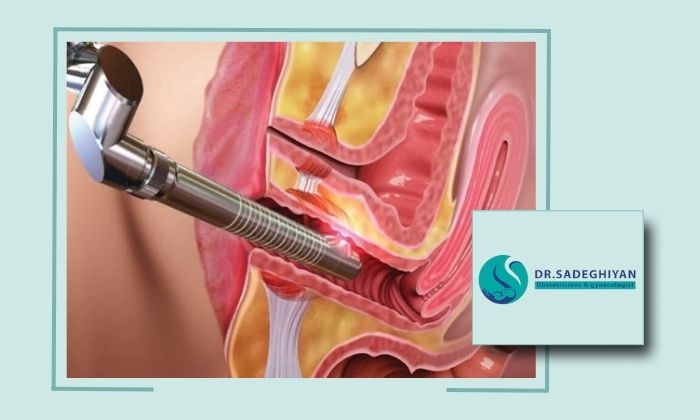 جوانسازی واژن با لیزر در یزد بدون درد و ناراحتی