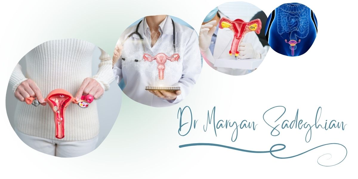 چرا مرکز دکتر صادقیان بهترین مرکز درمان افتادگی رحم در یزد است؟