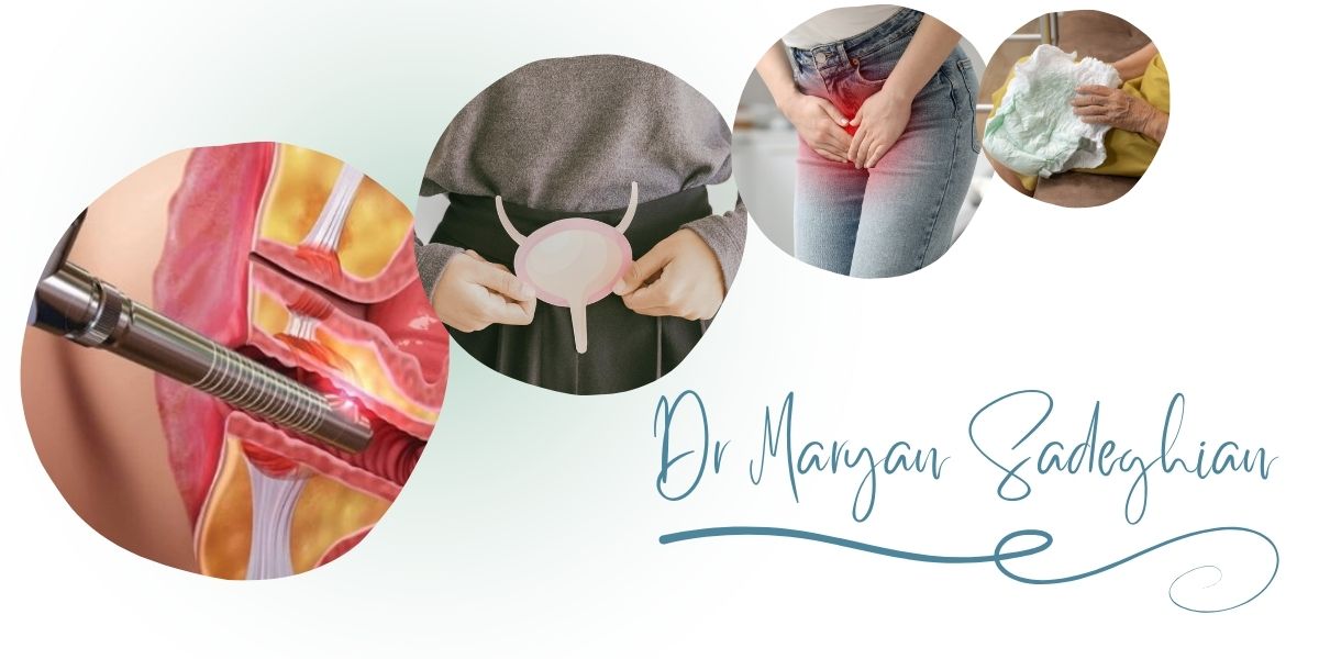 چرا دکتر صادقیان بهترین مرکز لیزر بی اختیاری ادرار در یزد است؟