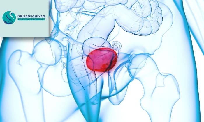 روش های پیشگیری