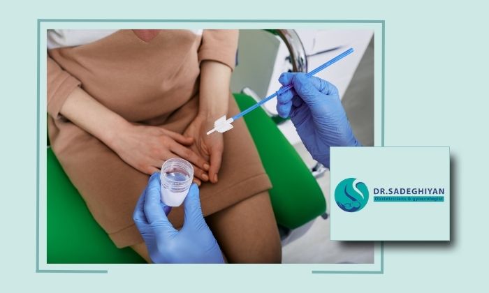 شرایط قبل و بعد از تست پاپ اسمیر،چه زمانی بهترین زمان است؟