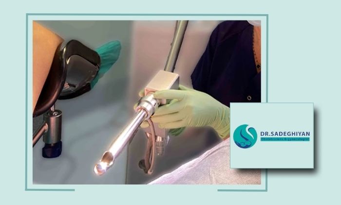 لیزر درمانی راهکار مؤثر برای مشکلات بهداشتی زنان