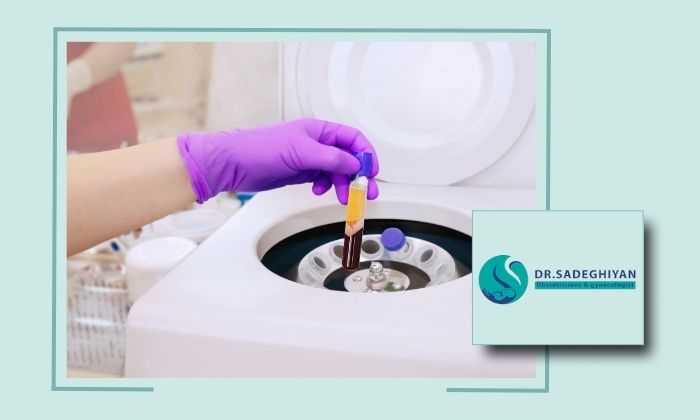 پلاسماتراپی واژن برای درمان عفونت زنان و بهترین پزشک آن در یزد