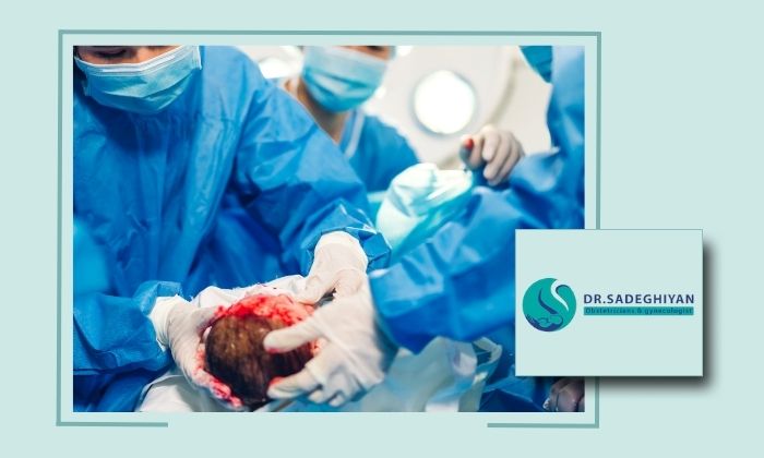 چگونه باید مراقبت‌های اولیه پس از سزارین را انجام دهم؟